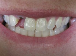 liznovitpre1-300x225
