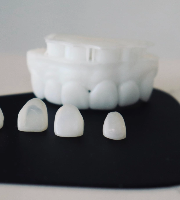 Porcelain Veneers