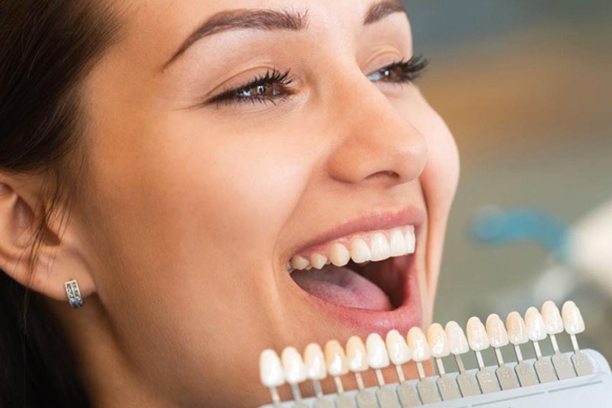Porcelain veneer treatment process at a cosmetic dental office in Grand Rapids, MI